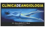 CLÍNICA DE ANGIOLOGIA